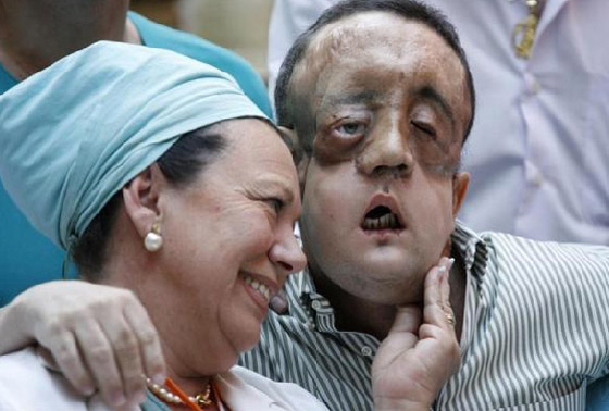 قريبا انجاز جديد لاسبانيا: اول عملية لزراعة ساق! قريبا انجاز جديد لاسبانيا: اول عملية لزراعة ساق!