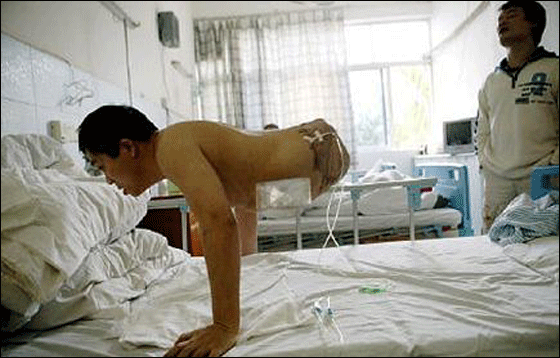 بعد استئصال نصفه افتتح متجر نصف رجل بنصف السعر! بعد استئصال نصفه افتتح متجر نصف رجل بنصف السعر!