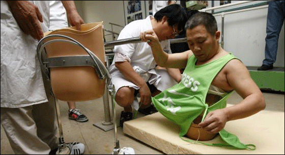 بعد استئصال نصفه افتتح متجر نصف رجل بنصف السعر! بعد استئصال نصفه افتتح متجر نصف رجل بنصف السعر!