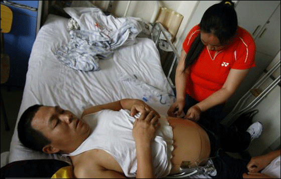 بعد استئصال نصفه افتتح متجر نصف رجل بنصف السعر! بعد استئصال نصفه افتتح متجر نصف رجل بنصف السعر!