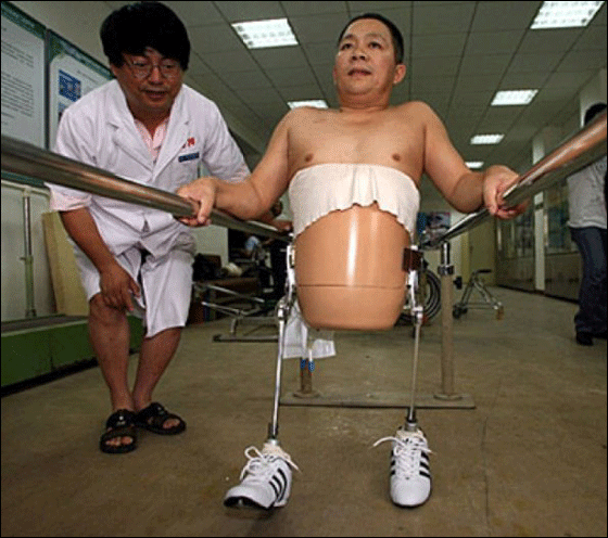 بعد استئصال نصفه افتتح متجر نصف رجل بنصف السعر! بعد استئصال نصفه افتتح متجر نصف رجل بنصف السعر!