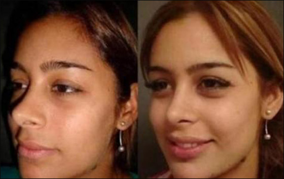 بالصور.. العارضة لاريسا قبل وبعد عمليات التجميل! بالصور.. العارضة لاريسا قبل وبعد عمليات التجميل!