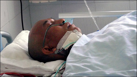 بعد 4 سنوات.. اكتشاف نصل بطول 10 سنتيمترات داخل وجه رجل! بعد 4 سنوات.. اكتشاف نصل بطول 10 سنتيمترات داخل وجه رجل!