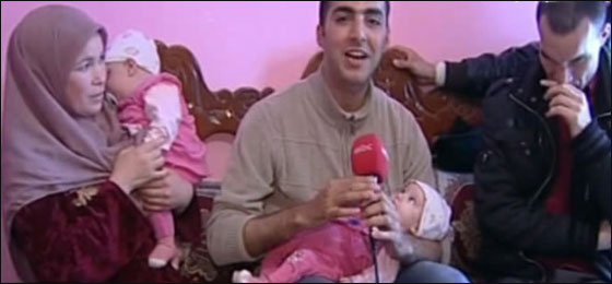 نجاح فصل توامين سياميين بعد امر خادم الحرمين بالتكفل بهما نجاح فصل توامين سياميين بعد امر خادم الحرمين بالتكفل بهما