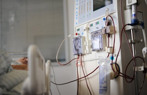 بكتيريا من نوع E.coli تنتشر بشكل خطير وتسبب وفيات بكتيريا من نوع E.coli تنتشر بشكل خطير وتسبب وفيات