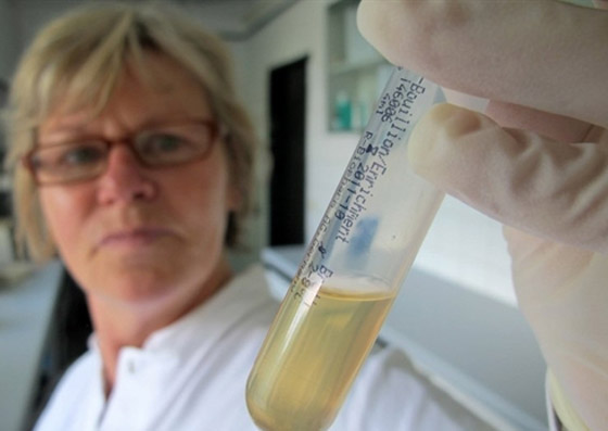 بكتيريا من نوع E.coli تنتشر بشكل خطير وتسبب وفيات بكتيريا من نوع E.coli تنتشر بشكل خطير وتسبب وفيات