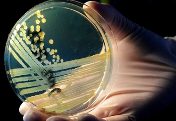 بكتيريا من نوع E.coli تنتشر بشكل خطير وتسبب وفيات بكتيريا من نوع E.coli تنتشر بشكل خطير وتسبب وفيات