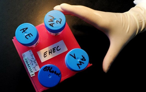 بكتيريا من نوع E.coli تنتشر بشكل خطير وتسبب وفيات بكتيريا من نوع E.coli تنتشر بشكل خطير وتسبب وفيات