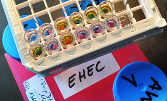 بكتيريا من نوع E.coli تنتشر بشكل خطير وتسبب وفيات بكتيريا من نوع E.coli تنتشر بشكل خطير وتسبب وفيات