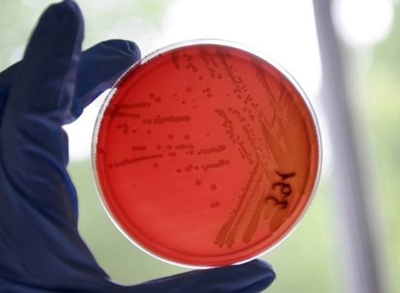 بكتيريا من نوع E.coli تنتشر بشكل خطير وتسبب وفيات بكتيريا من نوع E.coli تنتشر بشكل خطير وتسبب وفيات