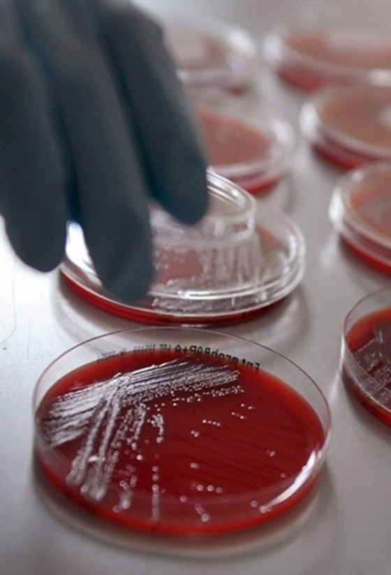 بكتيريا من نوع E.coli تنتشر بشكل خطير وتسبب وفيات بكتيريا من نوع E.coli تنتشر بشكل خطير وتسبب وفيات