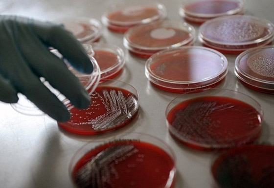 بكتيريا من نوع E.coli تنتشر بشكل خطير وتسبب وفيات بكتيريا من نوع E.coli تنتشر بشكل خطير وتسبب وفيات