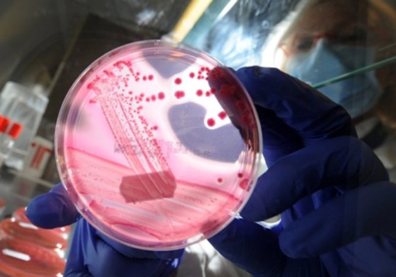 بكتيريا من نوع E.coli تنتشر بشكل خطير وتسبب وفيات بكتيريا من نوع E.coli تنتشر بشكل خطير وتسبب وفيات