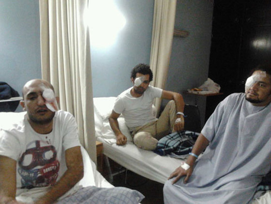 كفيف الثورة يفقد عينه اليمنى بـ 28 يناير واليسرى بـ 19 نوفمبر! كفيف الثورة يفقد عينه اليمنى بـ 28 يناير واليسرى بـ 19 نوفمبر!