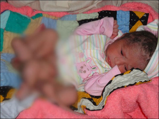 باكستان: ولادة رضيع بـ 6 أرجل وصحته جيدة! باكستان: ولادة رضيع بـ 6 أرجل وصحته جيدة!
