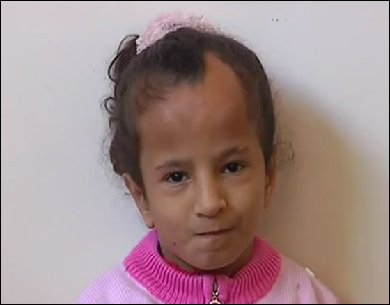 الطفلة بسملة عمرها 9 اعوام تقهر العجز الذي الم باطرافها! الطفلة بسملة عمرها 9 اعوام تقهر العجز الذي الم باطرافها!